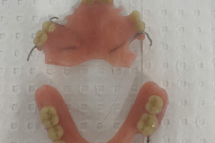 P/P Acrylic dentures