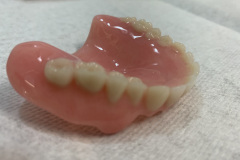 Open face F/- denture