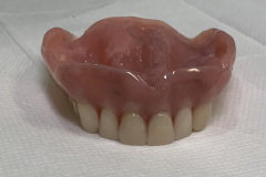 F/- denture