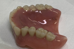 F/- denture