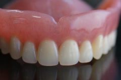 Full upper denture