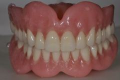 Full upper and lower dentures